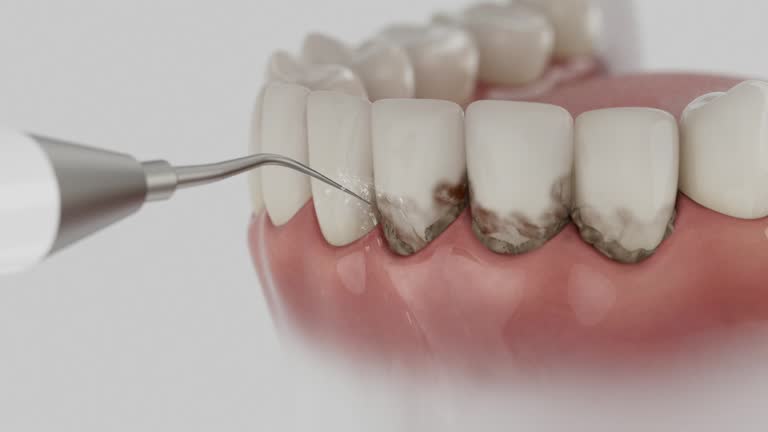 Reliable Dental Crowns And Bridges contractor in St. James Parish County, LA by Dentist Open Now